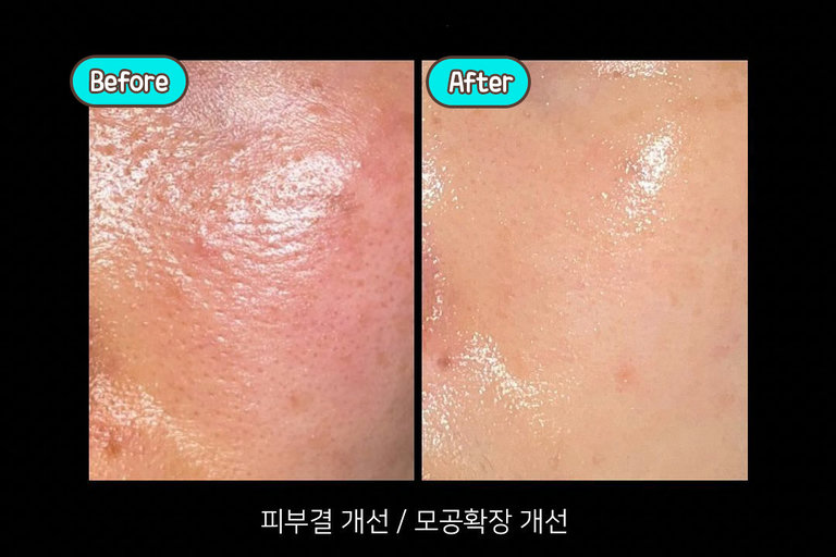 한 눈에 보는 비포&애프터
