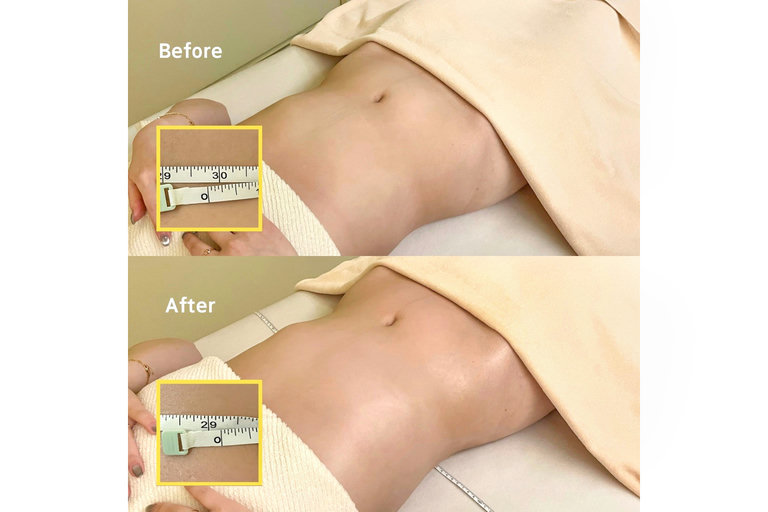 피부 케어와 복부 관리 효과✨