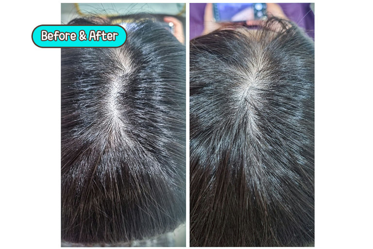 꼼꼼한 Before & After 비교로 마무리