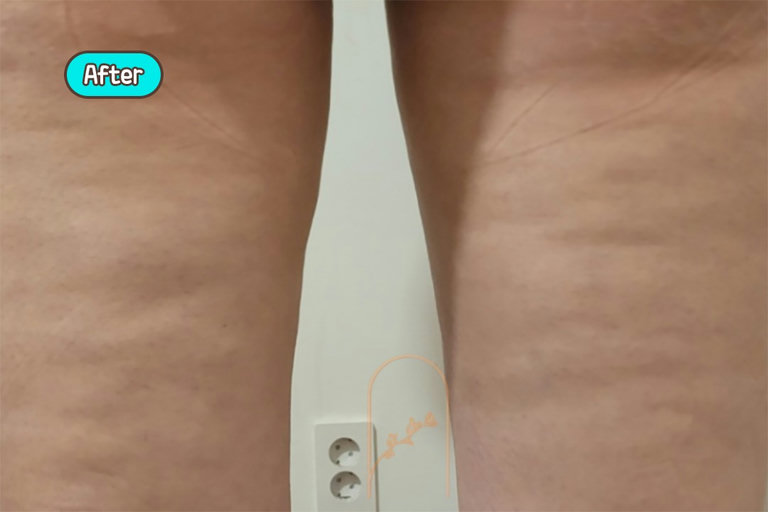 한눈에 보는 비포&애프터
