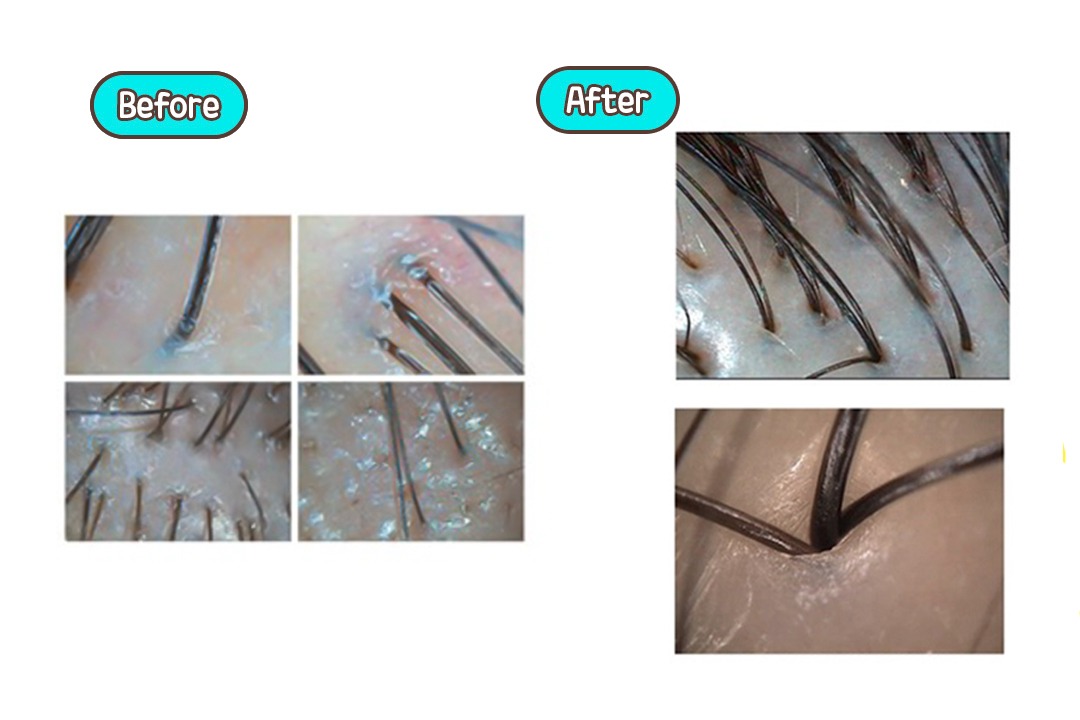 내 눈으로 직접 확인하는 Before & After